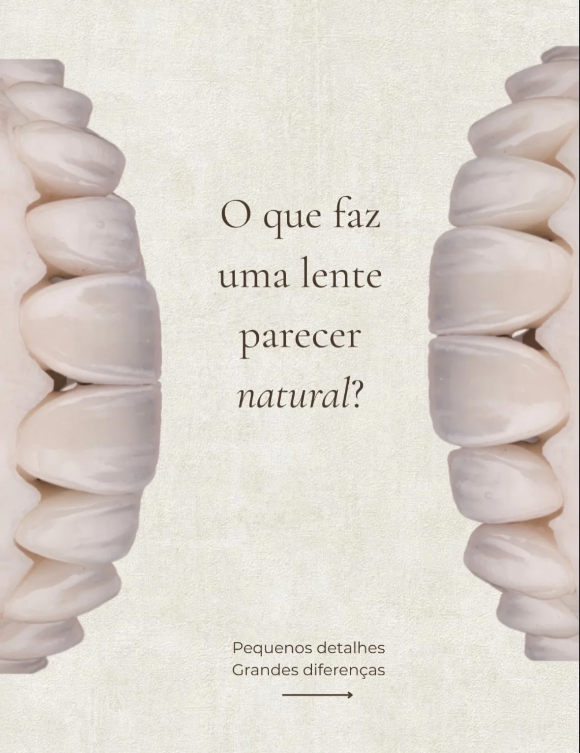 Conteúdo sobre naturalidade em lentes odontológicas